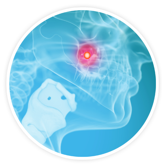 Dolor dental Dolor dental