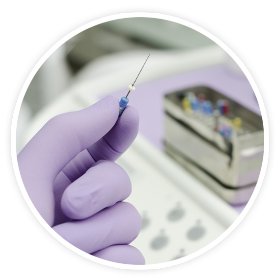 Tratamiento Endodoncia Tratamiento Endodoncia